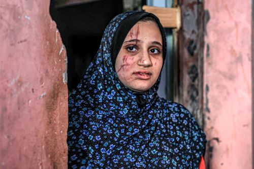 ظروف الحمل والولادة في قطاع غزة "أسوأ من جهنم"